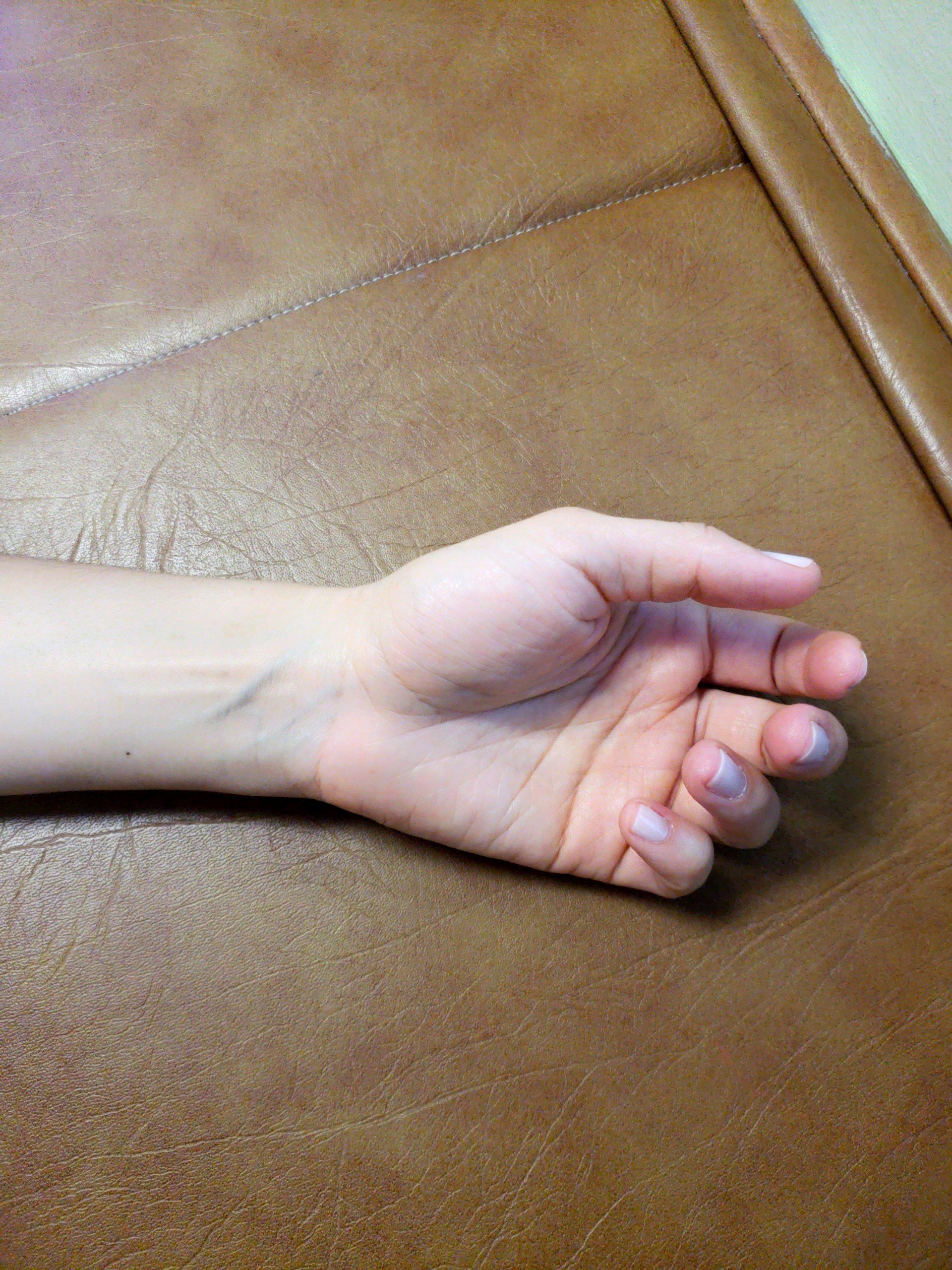 Are you suffering from Tendonitis?
