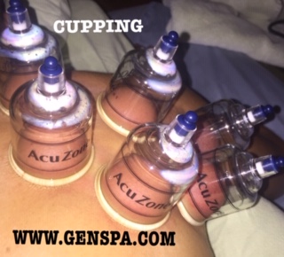 Gen Spa is now offering Cupping for Pain Relief