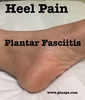 Sharp Heel Pain Treatment at Gen Spa