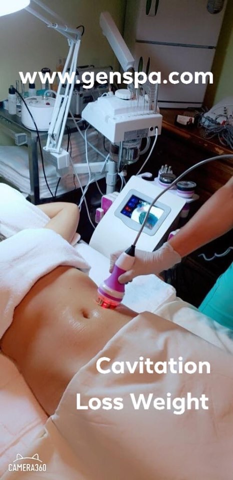 What is Ultrasonic Cavitation and how does it work?